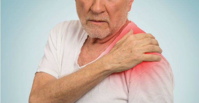 Rotator Cuff Tears